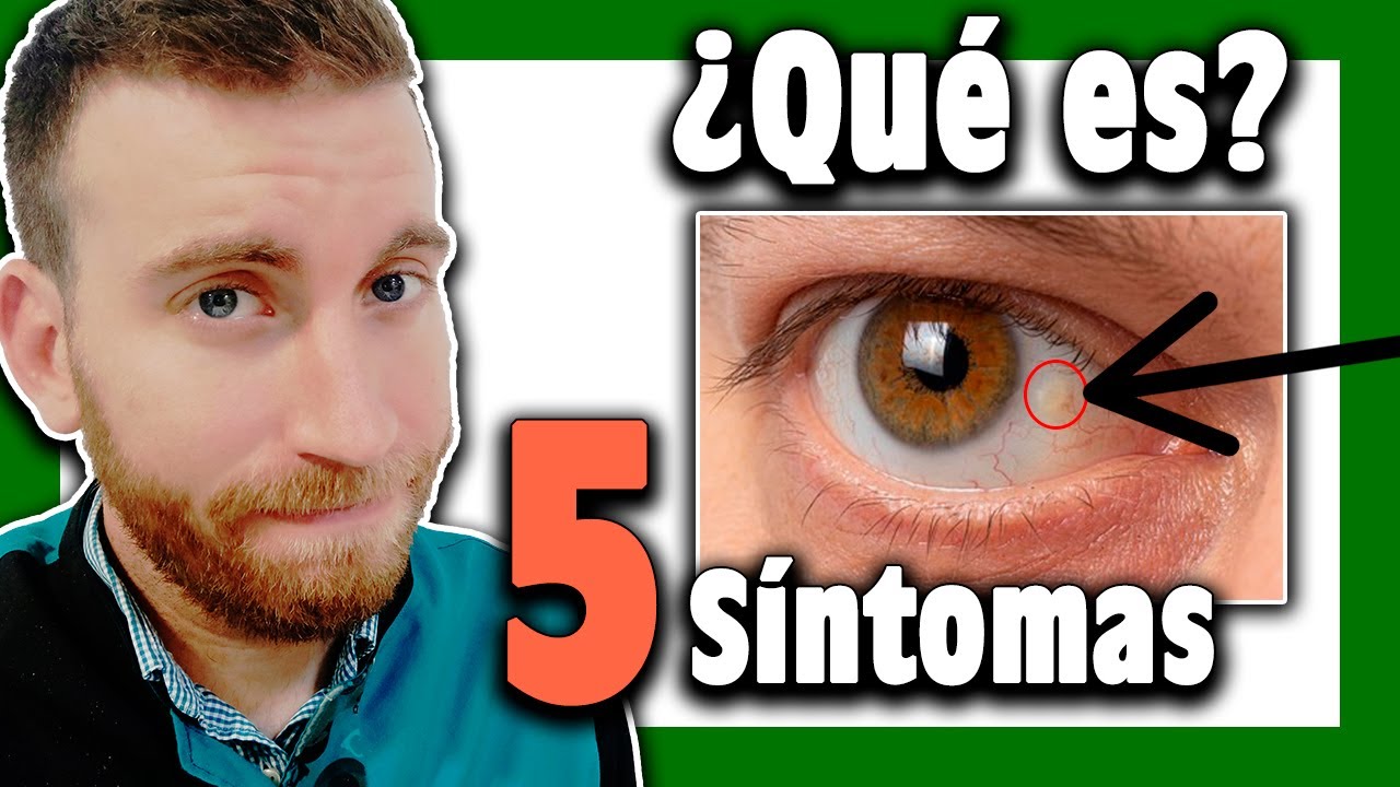 cómo se llama lo blanco del ojo