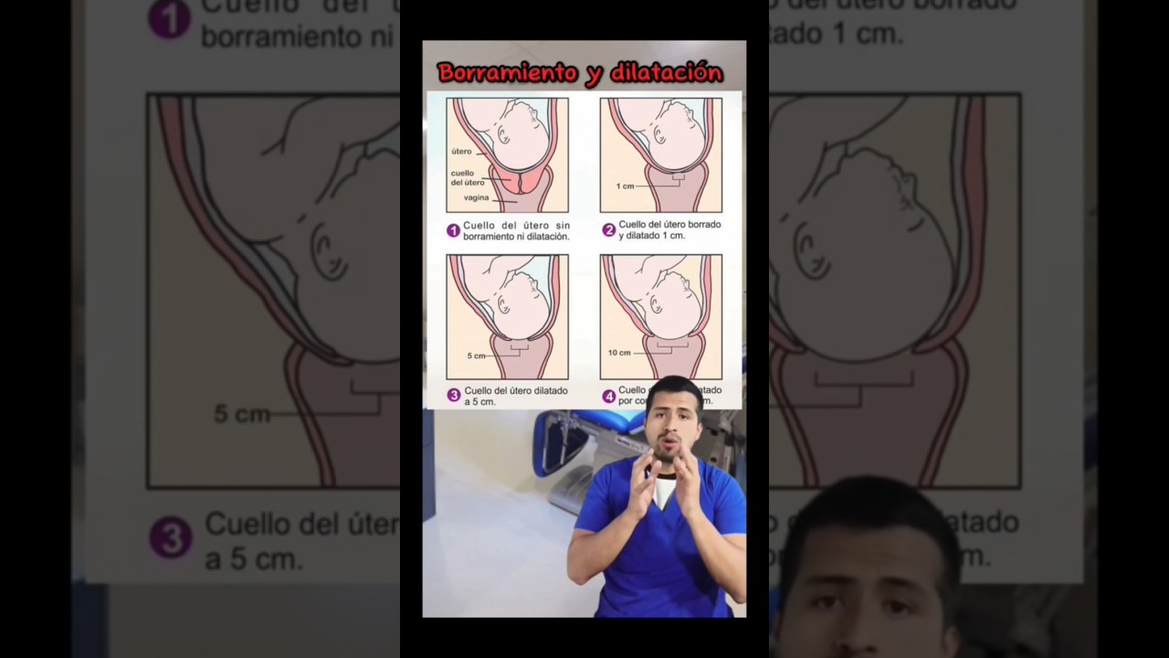 como saber si el cuello del utero esta borrado