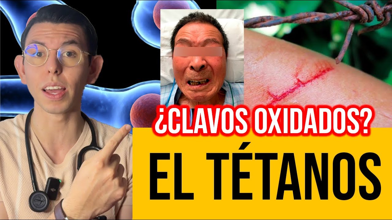que pasa si me corto con algo oxidado